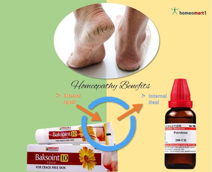 Bakson Baksoint 10 cream for cracked heels repair - Golden-Patel Son