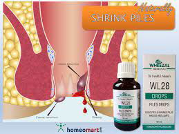Wheezal WL-28 Piles Drops (30ml) - Golden-Patel Son